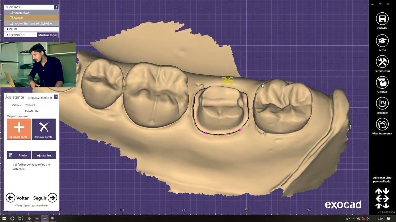 CAD/CAM — Design Digital
