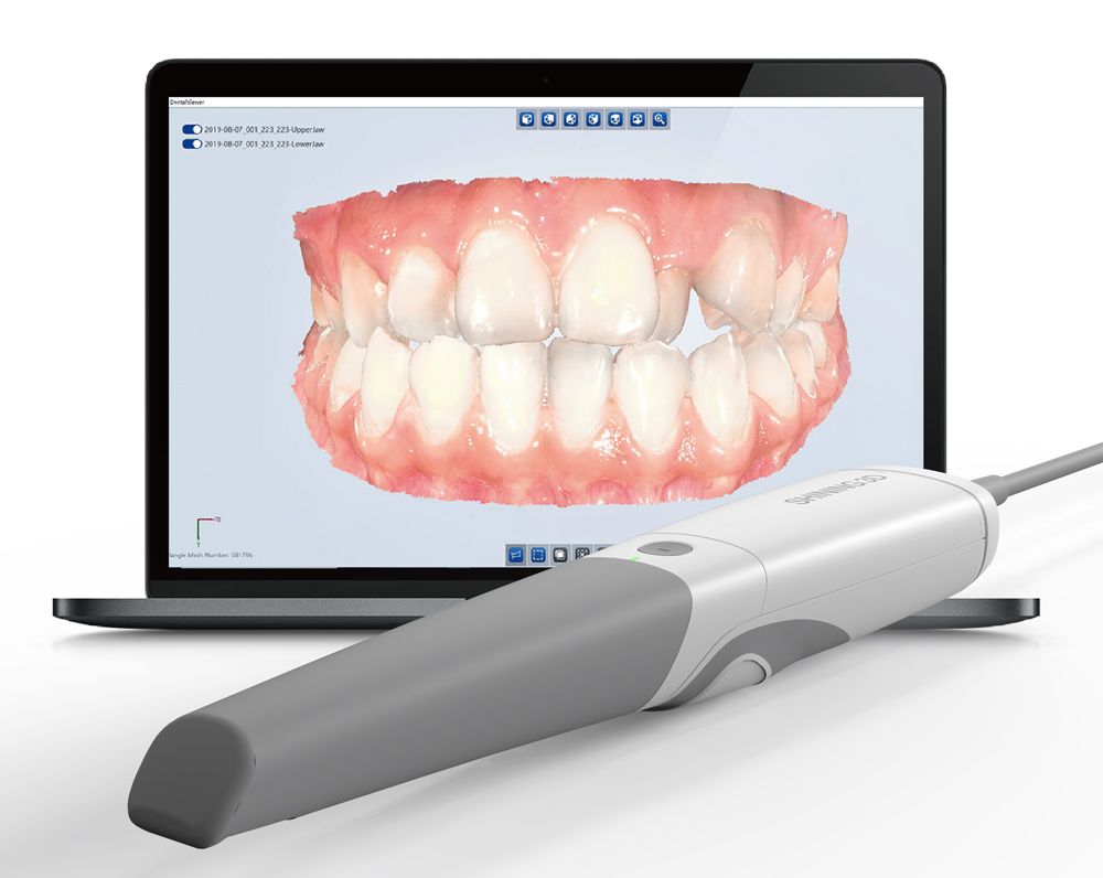 Scanner Intraoral Shining 3D